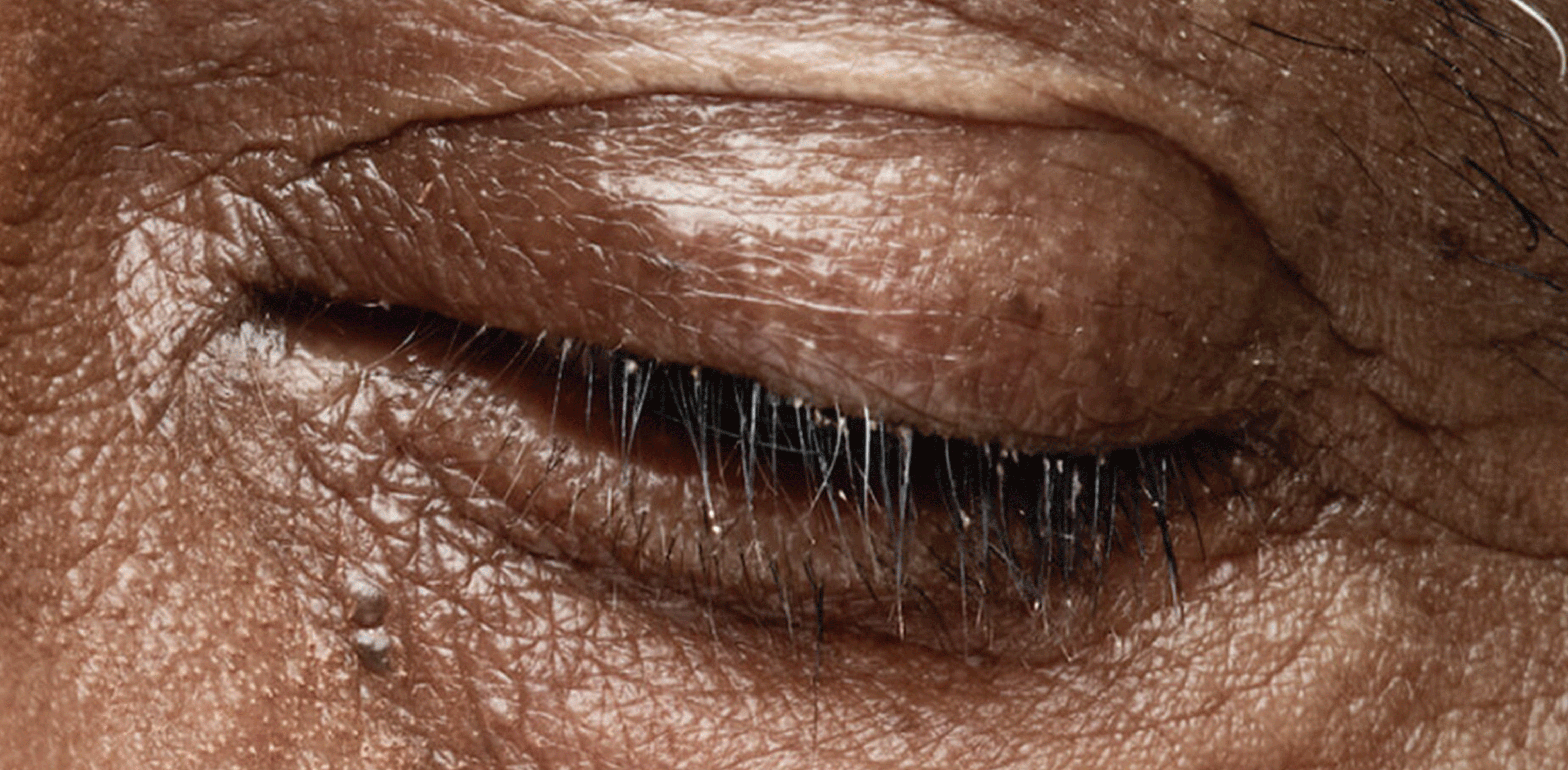 closeup of dark-skinned man’s closed eye
